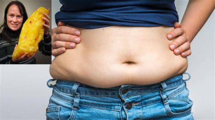 20lbs of Fat: Understanding the Health Implications and Solutions