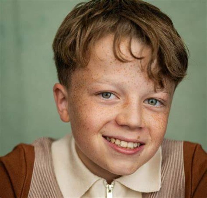 Charlie Hodson's Past Disability: Impact & Details
