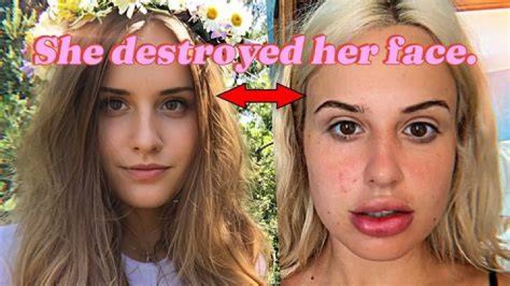 Did Blair Fleming Have Bottom Surgery? Details Explored