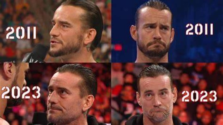 Did CM Punk Get a Hair Transplant? Exploring the Facts and Myths