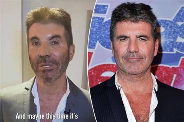 Did Simon Cowell Have a Car Wreck? Unveiling the Truth Behind the Rumors