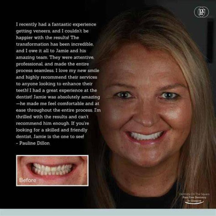 Glasgow Smile: A Revolutionary Approach to Oral Health and Confidence