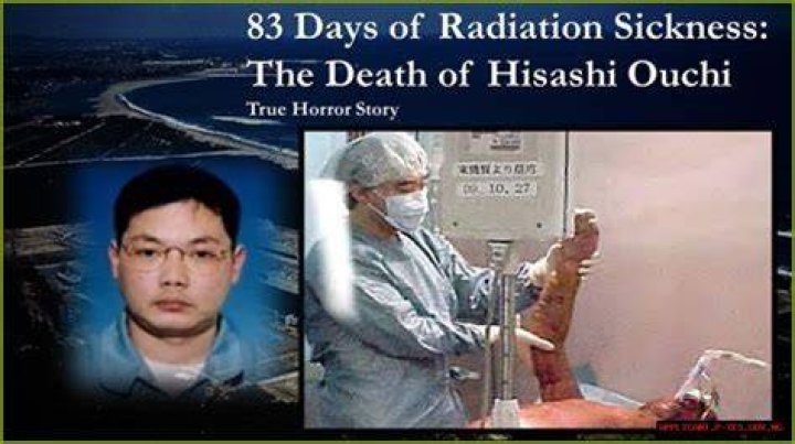 Hisashi Ouchi Death: Was It Real?