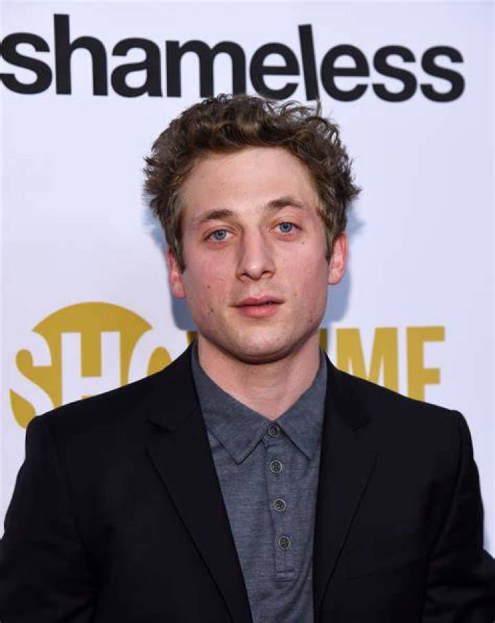 Jeremy Allen White Free Show: About Shameless