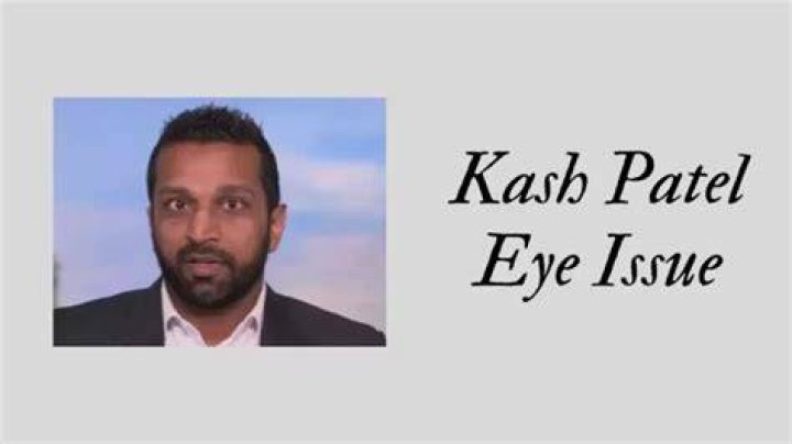 Kash Patel Lazy Eye: A Comprehensive Exploration