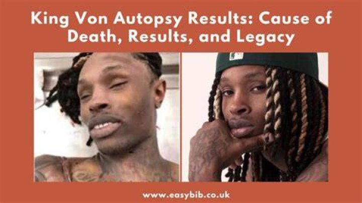 King Von Autopsy Results Released: What They Showed