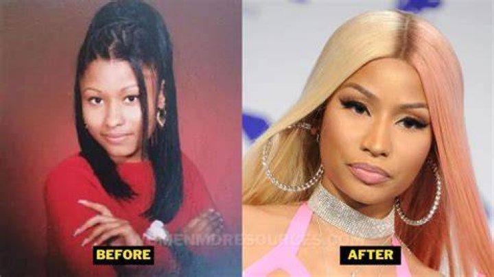 Nicki Minaj Before Any Surgery: A Journey Through Her Early Life and Transformation