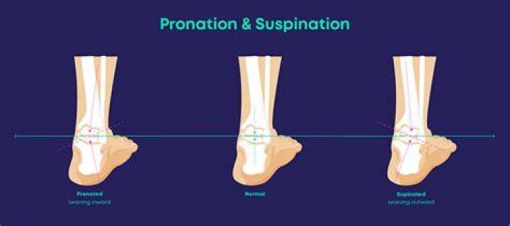 Tiffany Stratton Foot: The Ultimate Guide to Understanding and Managing Foot Health