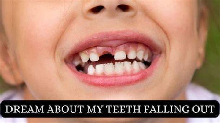 Unraveling the Mystery: Why Were Gypsies' Teeth Falling Out?