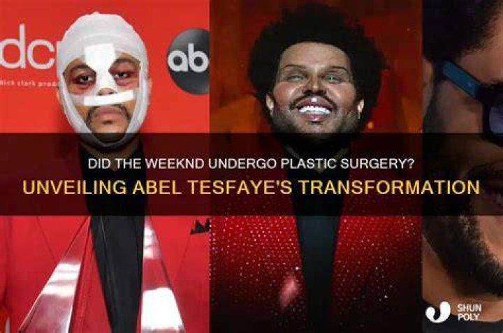 Unveiling Abel Tesfaye's Ethnicity: A Comprehensive Exploration