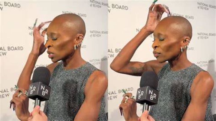 Why Is Cynthia Erivo Bald? Unveiling the Truth Behind Her Bold Look